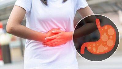 Näringsregler för gastrit i magen